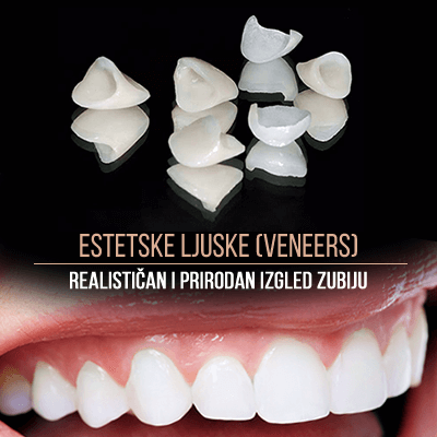 Ljuskice estetika